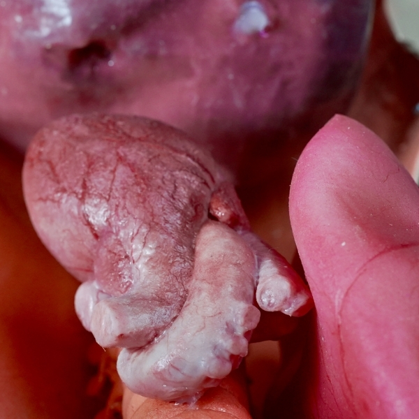 Hyperrealistic silicone anatomical model for medical simulation training — synthetic product, not real human tissue