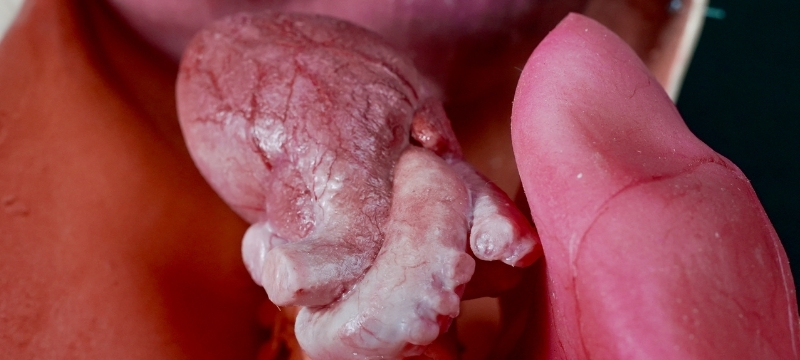 Synthetic silicone organ model for surgical training simulation - not real tissue