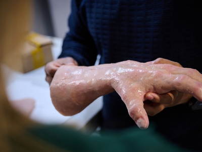 Synthetic silicone hand model for medical training and prosthetic research